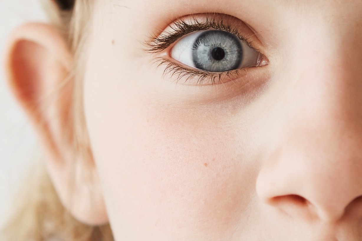 Tratamientos de oftalmología infantil